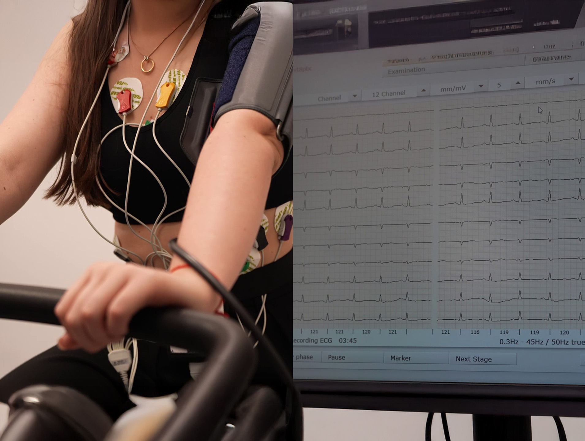 Cardiac Stress Test (Ergometry)