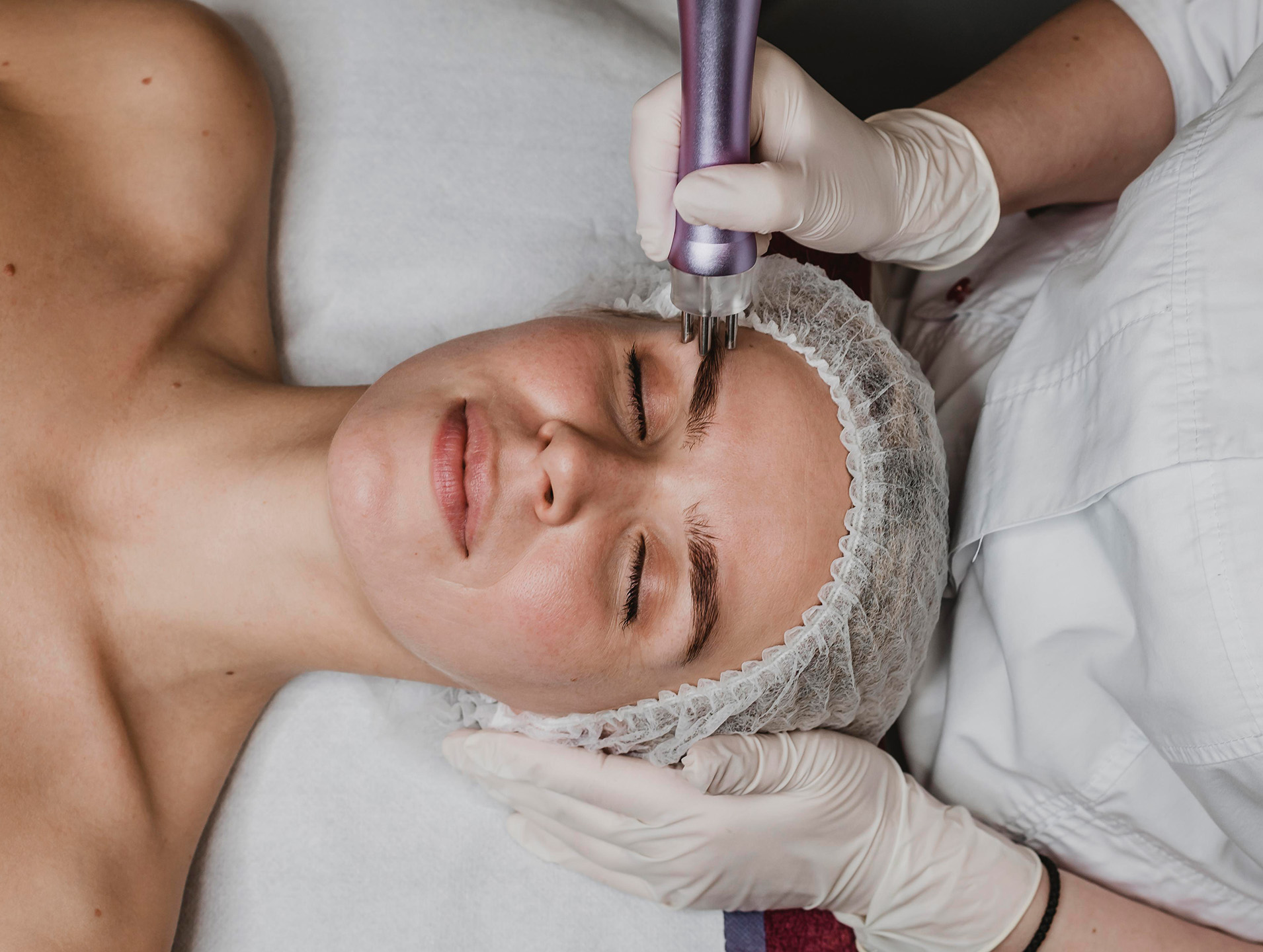 Fractional CO₂ Laser