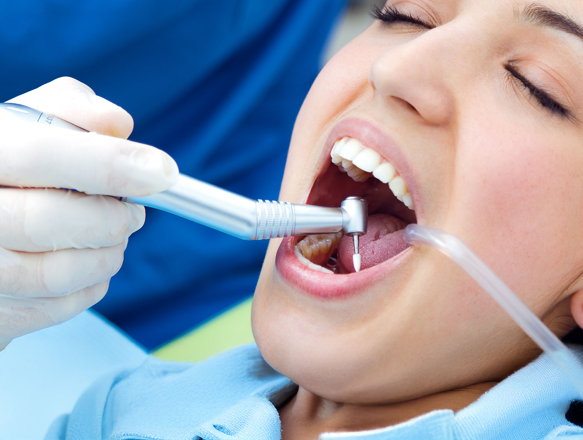 Professional Dental Cleaning