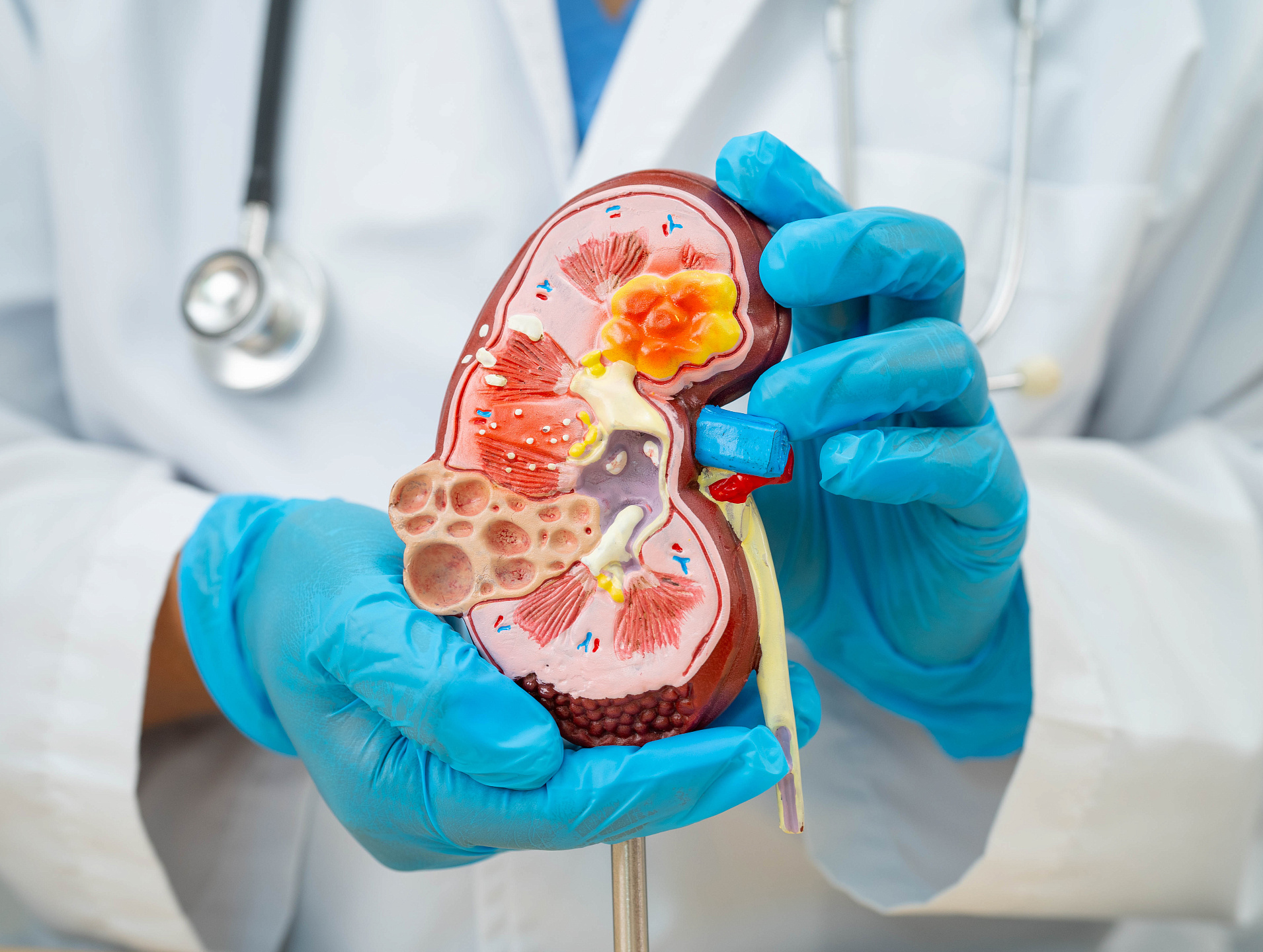 Нефрология