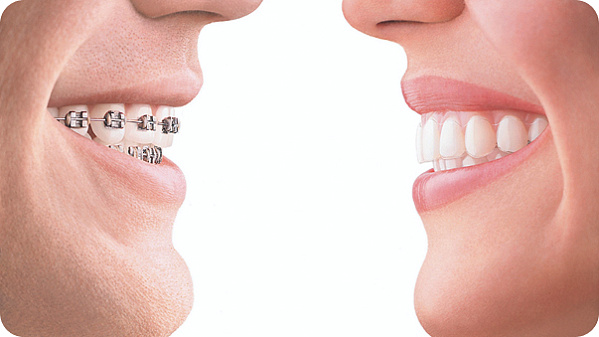 World-Class Orthodontics at Polyclinic.ae